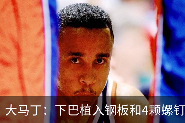 大马丁：下巴植入钢板和4颗螺钉，现在只能吃流食